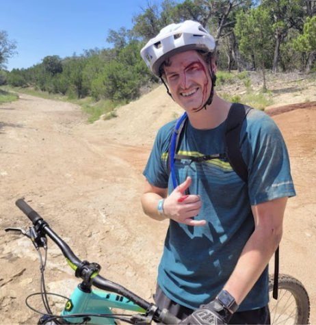 Ninth grade biology teacher Barrett Mick smiles for a photo after a mountain biking accident. 